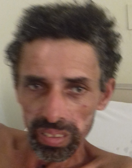 Paciente nº sessp-sgpni-11309.jpg